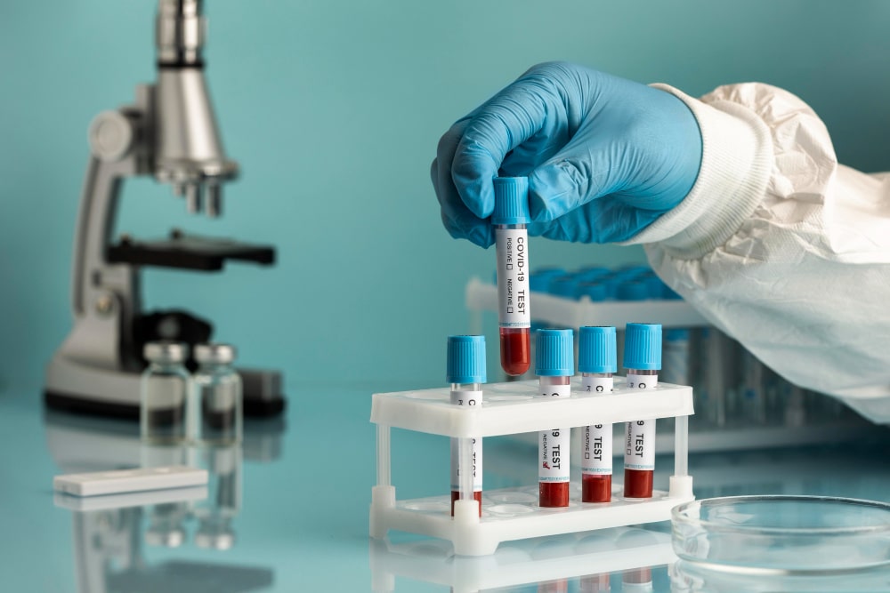 O que é patologia: mão de um médico em um laboratório segurando um frasco com amostras de sangue. Na mesa, além do recipiente, tem um microscópio para para analisar as amostras.