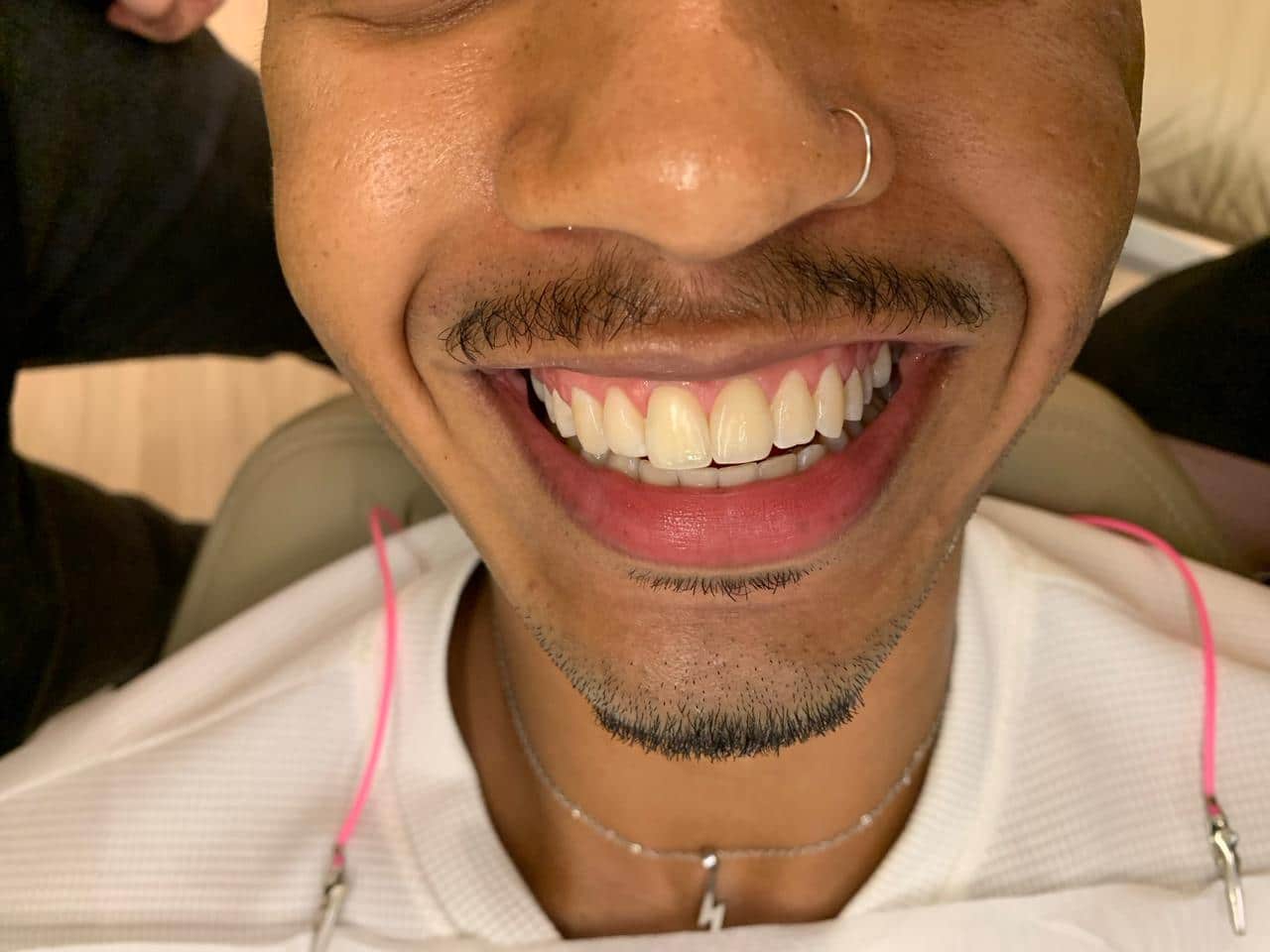 Close de jovem sorrindo durante avaliação odontológica, destacando dentes saudáveis em apoio à campanha Julho Neon de conscientização sobre a saúde bucal.